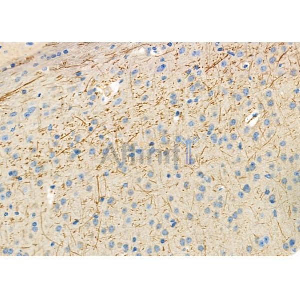 SHC2 Antibody - DF4506 at 1/100 staining Mouse brain tissue by IHC-P.