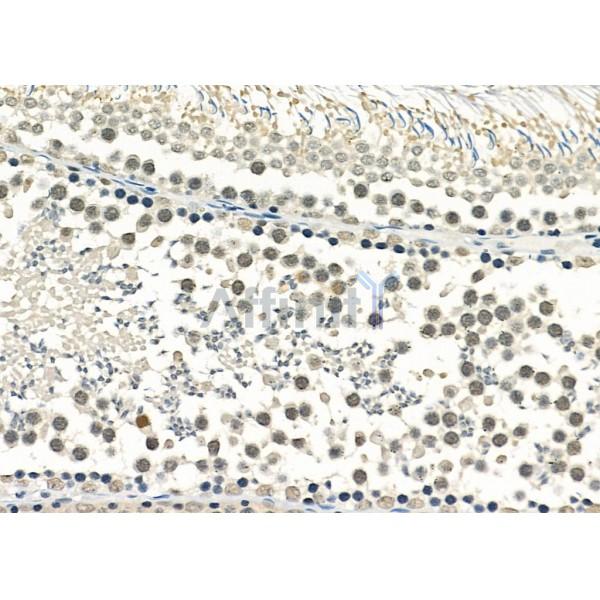 RALY Antibody - DF4657 at 1/100 staining Rat testis tissue by IHC-P.