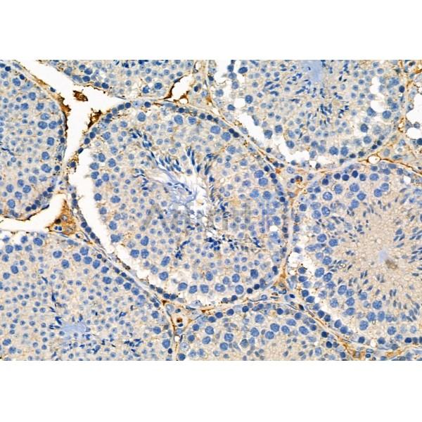 BID Antibody - DF6016 at 1/100 staining Mouse testis tissue by IHC-P.