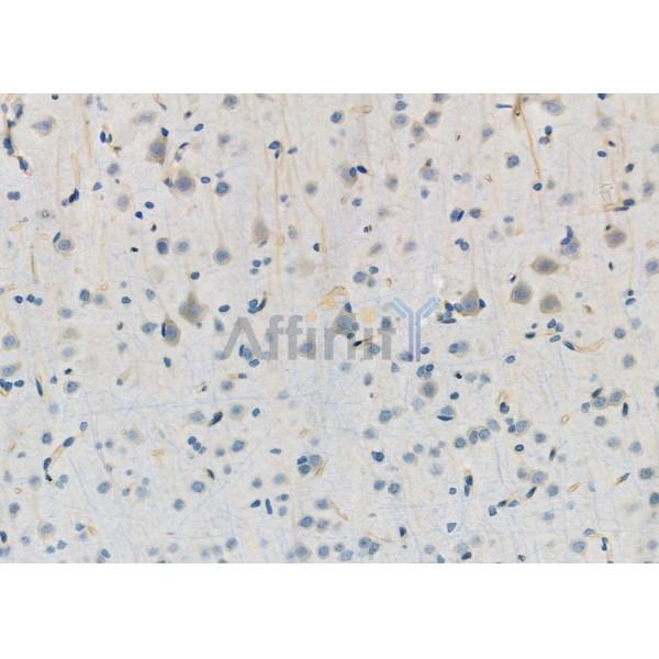 GSS Antibody - DF6214 at 1/100 staining Rat brain tissue by IHC-P.