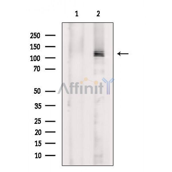 FAK Antibody - Western blot analysis of extracts from COS-7 cells(uv treatment), using FAK Antibody.