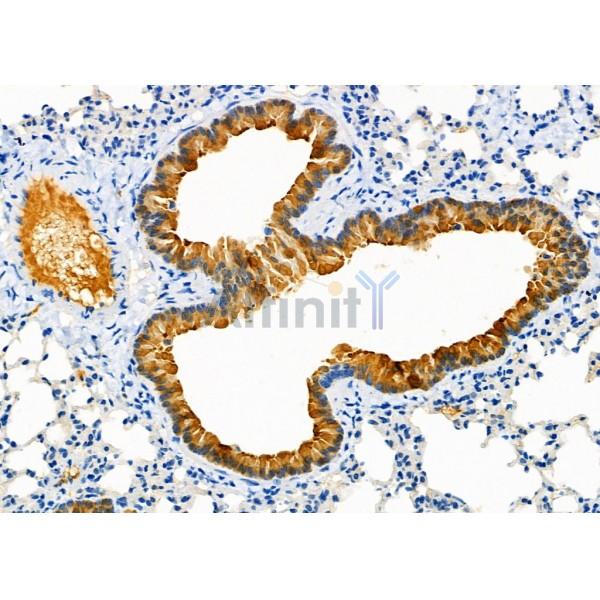NRP2 Antibody - DF7032 at 1/100 staining Mouse lung tissue by IHC-P.