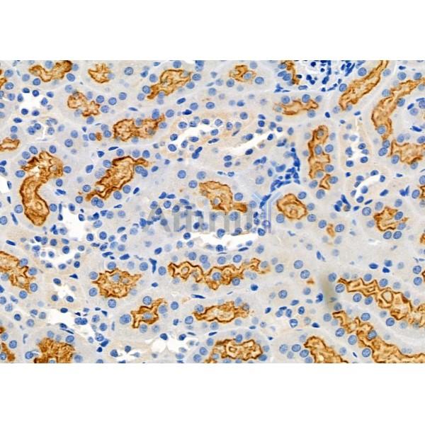 NRP2 Antibody - DF7032 at 1/100 staining Mouse kidney tissue by IHC-P.