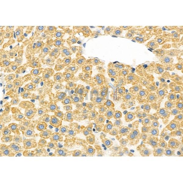 CFHR1 Antibody - DF7070 at 1/100 staining Rat liver tissue by IHC-P.
