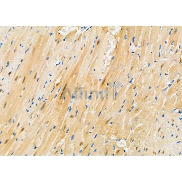 PIWIL4 Antibody - DF7207 at 1/100 staining Mouse heart tissue by IHC-P.