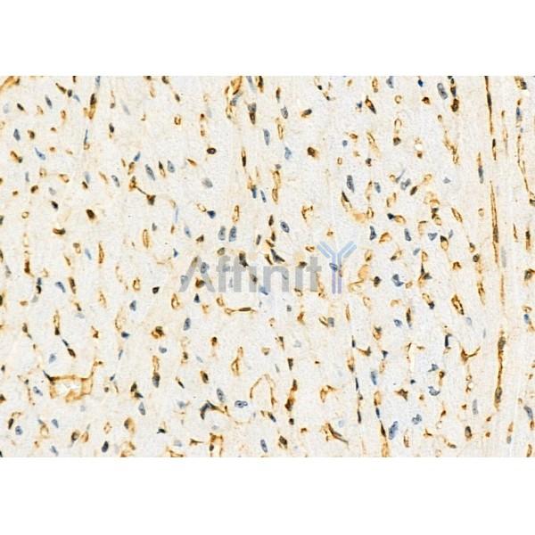 Wnt7a Antibody - DF7338 at 1/100 staining Mouse heart tissue by IHC-P.