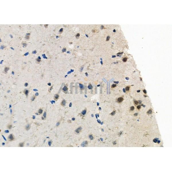 Otx2 Antibody - DF7360 at 1/100 staining Rat brain tissue by IHC-P.