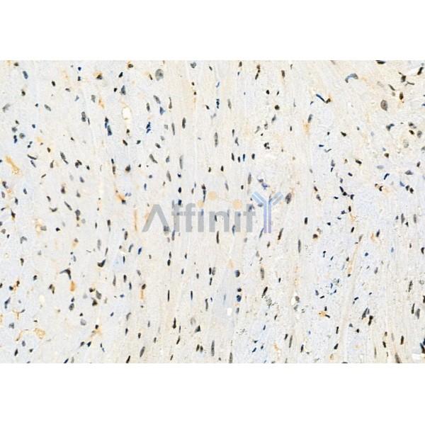 SIGMAR1 Antibody - DF7363 at 1/100 staining mouse muscle tissue by IHC-P.
