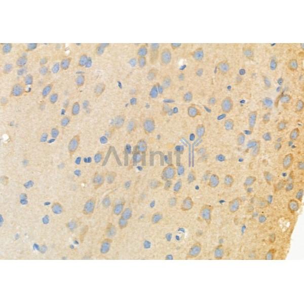 ATIC Antibody - DF7399 at 1/100 staining Rat brain tissue by IHC-P.