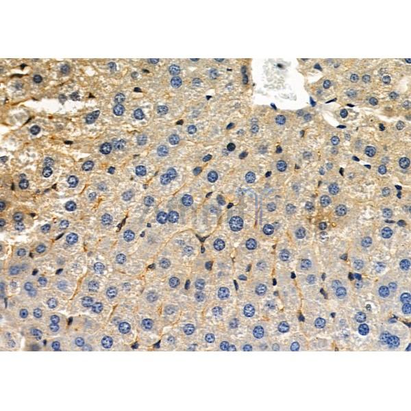 CLCN3 Antibody - DF7590 at 1/100 staining Mouse liver tissue by IHC-P.