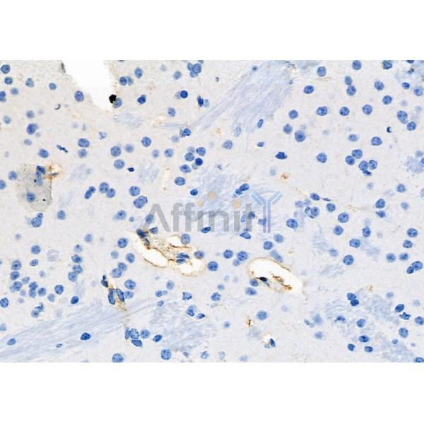 SCARF1 Antibody - DF7922 at 1/100 staining Mouse brain tissue by IHC-P.