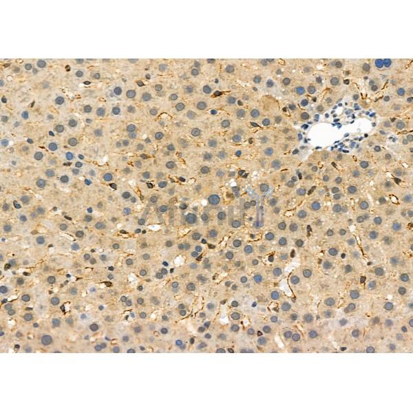 SCARF1 Antibody - DF7922 at 1/100 staining Rat liver tissue by IHC-P.