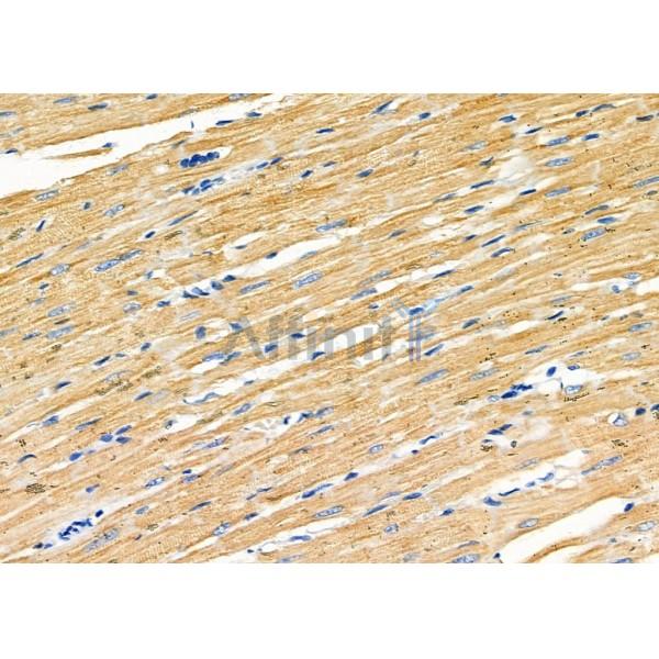 GRIA4 Antibody - DF7951 at 1/100 staining Rat heart tissue by IHC-P.