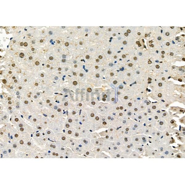 FTO Antibody - DF8421 at 1/100 staining Mouse liver tissue by IHC-P.