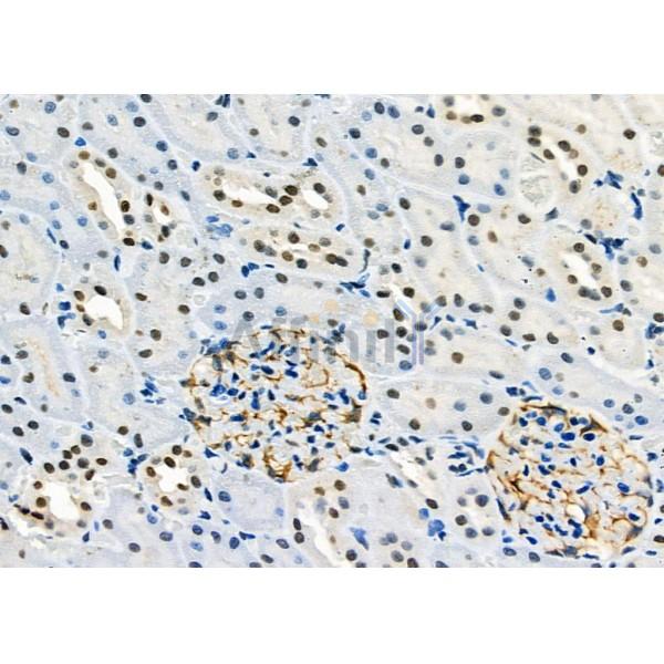 FTO Antibody - DF8421 at 1/100 staining Rat kidney tissue by IHC-P.