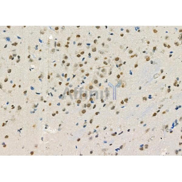 FTO Antibody - DF8421 at 1/100 staining Rat brain tissue by IHC-P.