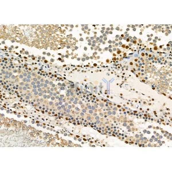 FTO Antibody - DF8421 at 1/100 staining Rat testis tissue by IHC-P.