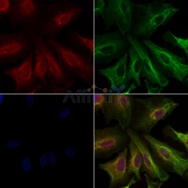 WNT5B Antibody - DF8438 staining A549 cells by IF/ICC.