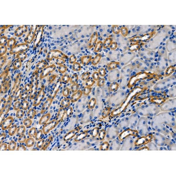 RAB35 Antibody - DF8710 at 1/100 staining Mouse kidney tissue by IHC-P.