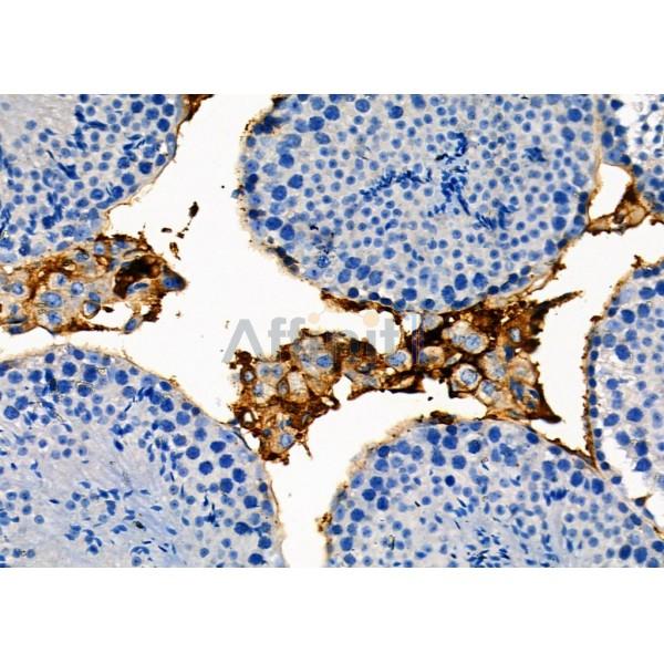 RAB35 Antibody - DF8710 at 1/100 staining Mouse testis tissue by IHC-P.