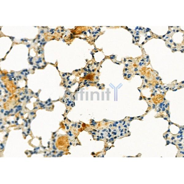 SLC30A8 Antibody - DF8719 at 1/100 staining Mouse kidney tissue by IHC-P.