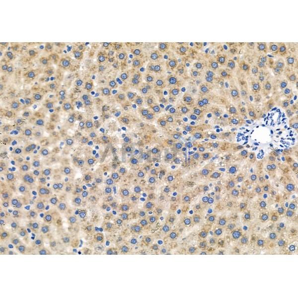 KR1_HHV11 Antibody - DF8776 at 1/100 staining Rat liver tissue by IHC-P.