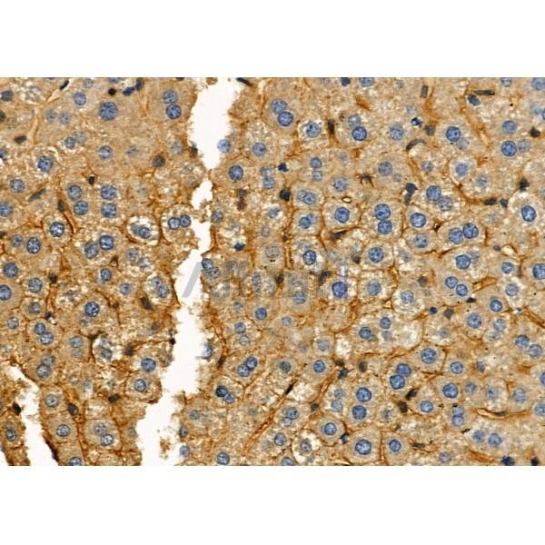 NKTR Antibody - DF8795 at 1/100 staining Mouse liver tissue by IHC-P.