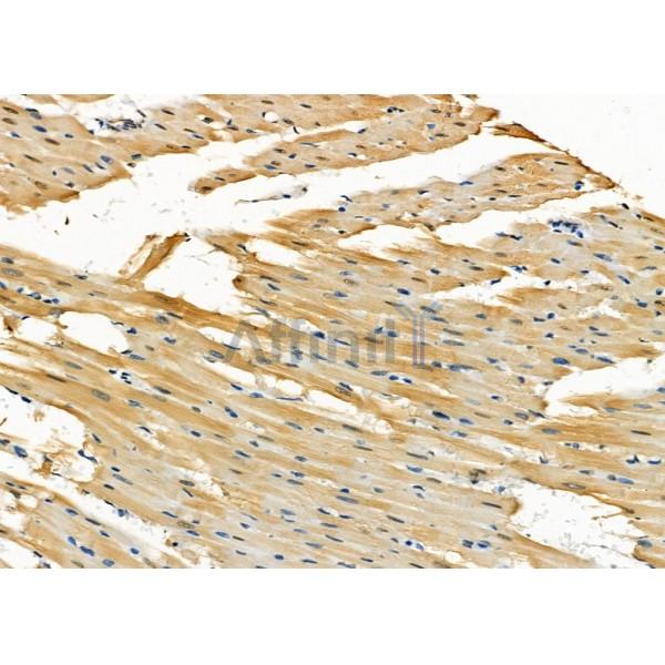 GCVK_HHV7J Antibody - DF8802 at 1/100 staining Rat heart tissue by IHC-P.
