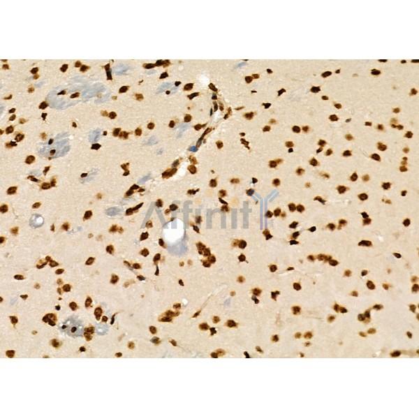 TF2A2 Antibody - DF8804 at 1/100 staining Mouse brain tissue by IHC-P.