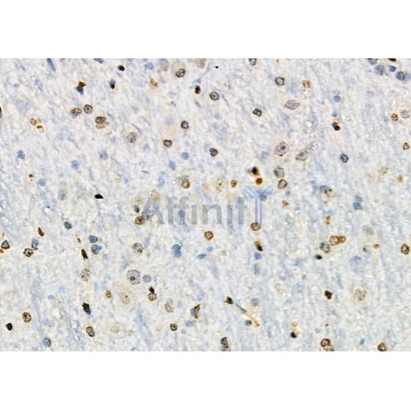 TF2A2 Antibody - DF8804 at 1/100 staining Rat brain tissue by IHC-P.