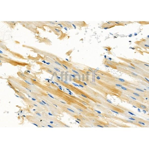 WIT1 Antibody - DF8816 at 1/100 staining Rat heart tissue by IHC-P.