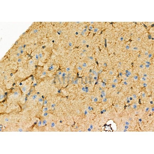 TNFAIP8L1 Antibody - DF8851 at 1/100 staining Mouse brain tissue by IHC-P.