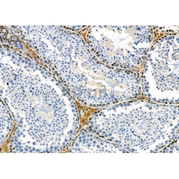 Collagen XVI  alpha 1 Antibody - DF8906 at 1/100 staining Mouse testis tissue by IHC-P.