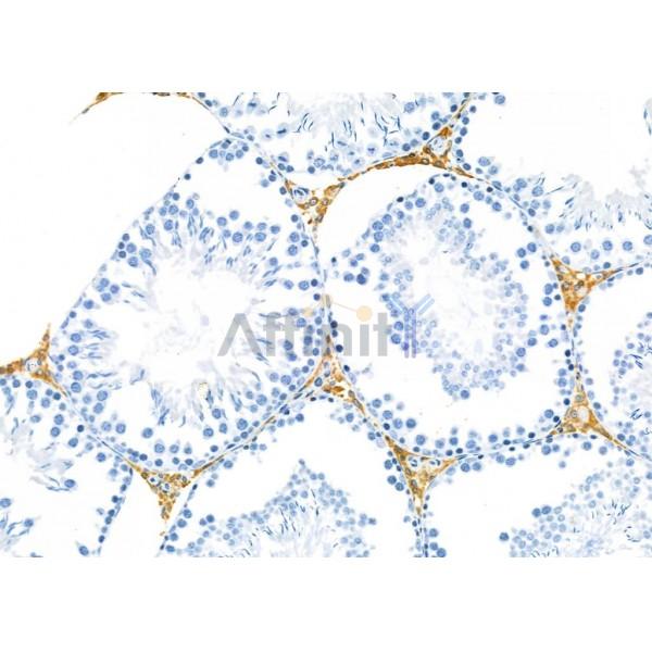 Collagen XVI  alpha 1 Antibody - DF8906 at 1/100 staining Rat testis tissue by IHC-P.