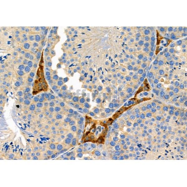 Cytochrome P450 27C1 Antibody - DF8922 at 1/100 staining Mouse testis tissue by IHC-P.