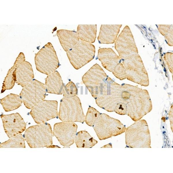 Cytochrome P450 27C1 Antibody - DF8922 at 1/100 staining Mouse muscle tissue by IHC-P.