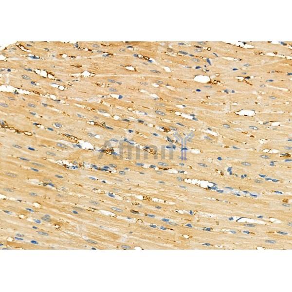 Cytochrome P450 27C1 Antibody - DF8922 at 1/100 staining Rat heart tissue by IHC-P.