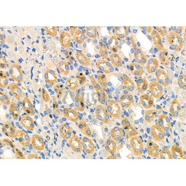 Cytochrome P450 27C1 Antibody - DF8922 at 1/100 staining Rat kidney tissue by IHC-P.