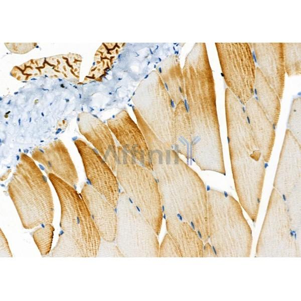 Cytochrome P450 27C1 Antibody - DF8922 at 1/100 staining Rat muscle tissue by IHC-P.