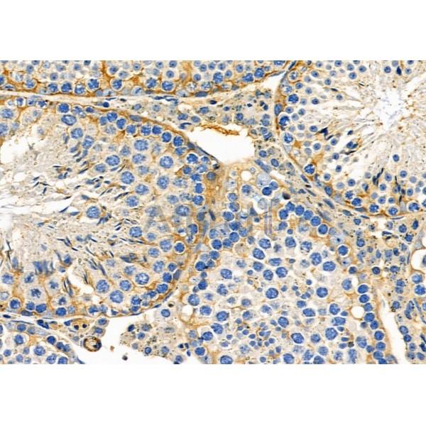 CRLF3 Antibody - DF8931 at 1/100 staining Mouse testis tissue by IHC-P.