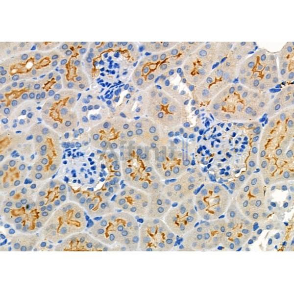 FGF16 Antibody - DF8945 at 1/100 staining Rat liver tissue by IHC-P.