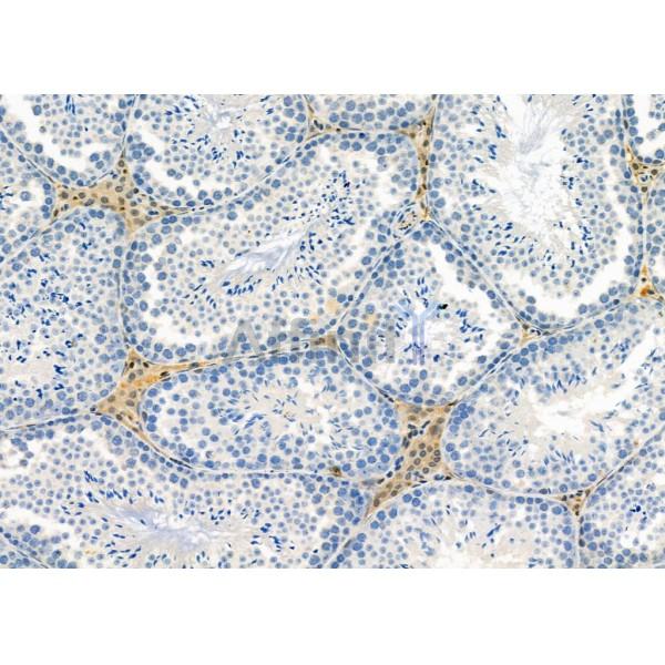 IFRD2 Antibody - DF8975 at 1/100 staining Mouse testis tissue by IHC-P.