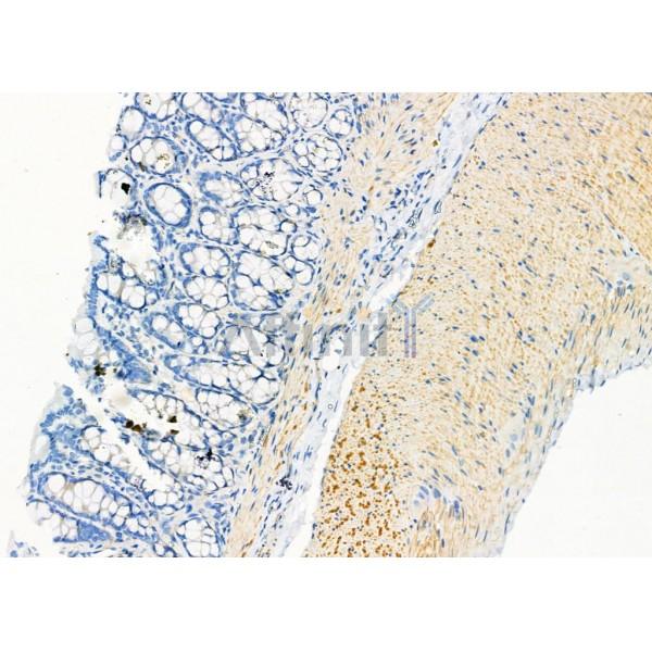 Cytokeratin 9 Antibody - DF9001 at 1/100 staining Rat stomach tissue by IHC-P.