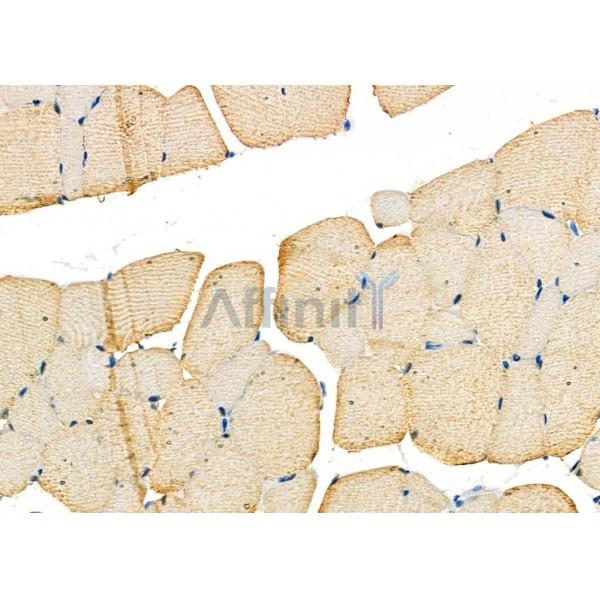 STRN4 Antibody - DF9065 at 1/100 staining Rat muscle tissue by IHC-P.