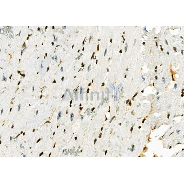 MYCNOS Antibody - DF9068 at 1/100 staining Mouse heart tissue by IHC-P.