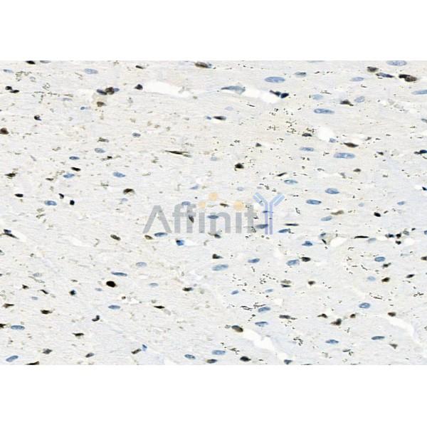 MYCNOS Antibody - DF9068 at 1/100 staining Rat heart tissue by IHC-P.