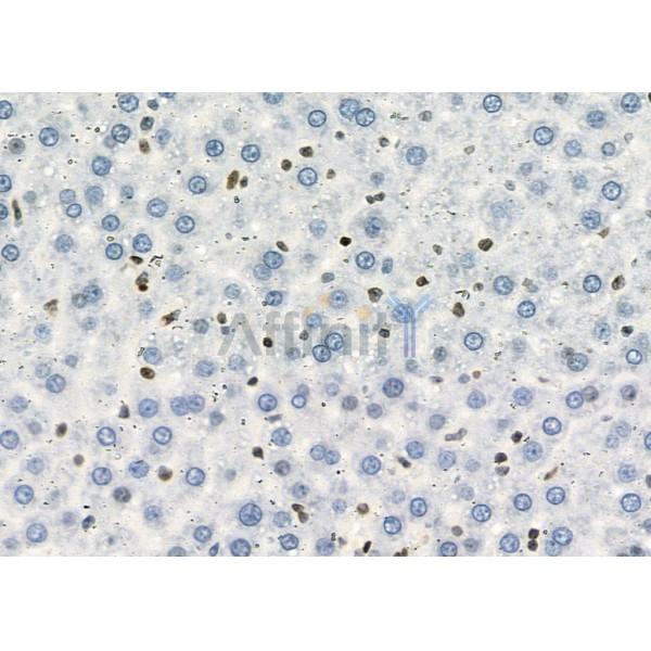 MYCNOS Antibody - DF9068 at 1/100 staining Rat liver tissue by IHC-P.