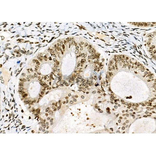NKAP Antibody - DF9069 at 1/100 staining mouse muscle tissue by IHC-P.