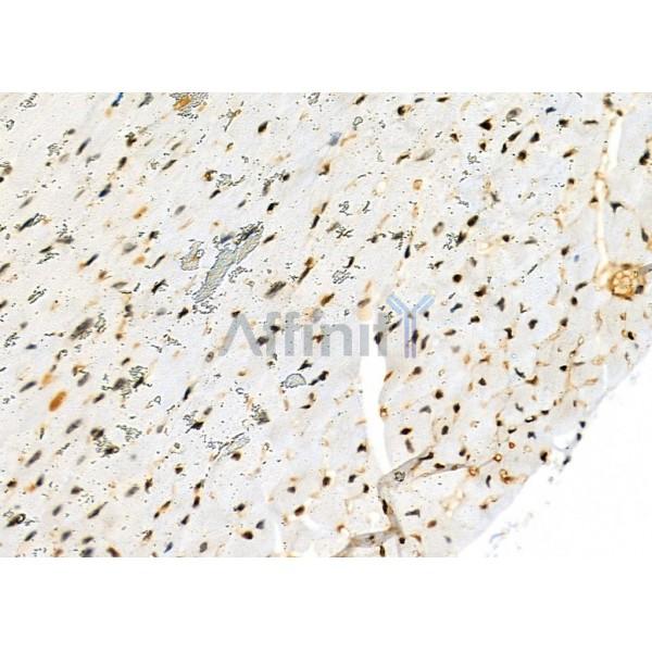 NKAP Antibody - DF9069 at 1/100 staining Mouse heart tissue by IHC-P.