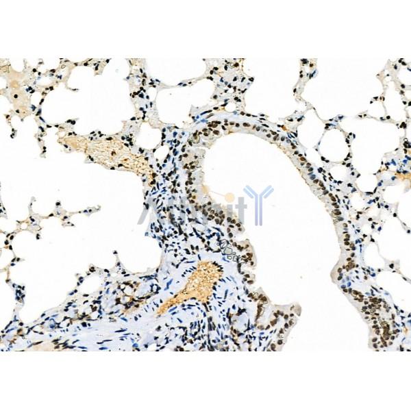 NKAP Antibody - DF9069 at 1/100 staining Mouse lung tissue by IHC-P.